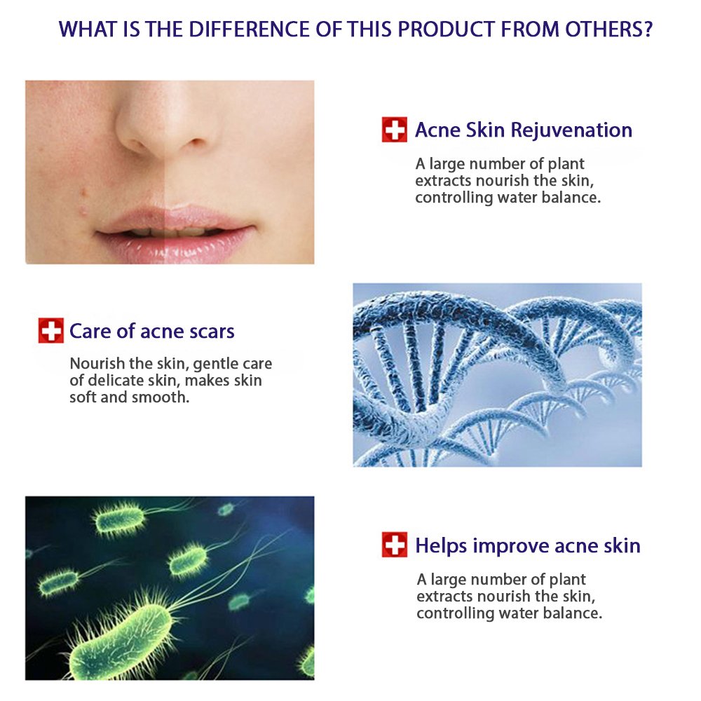 Pack De 10 Mascarillas Faciales Bioaqua Acne Removal Aclarante Hidratante