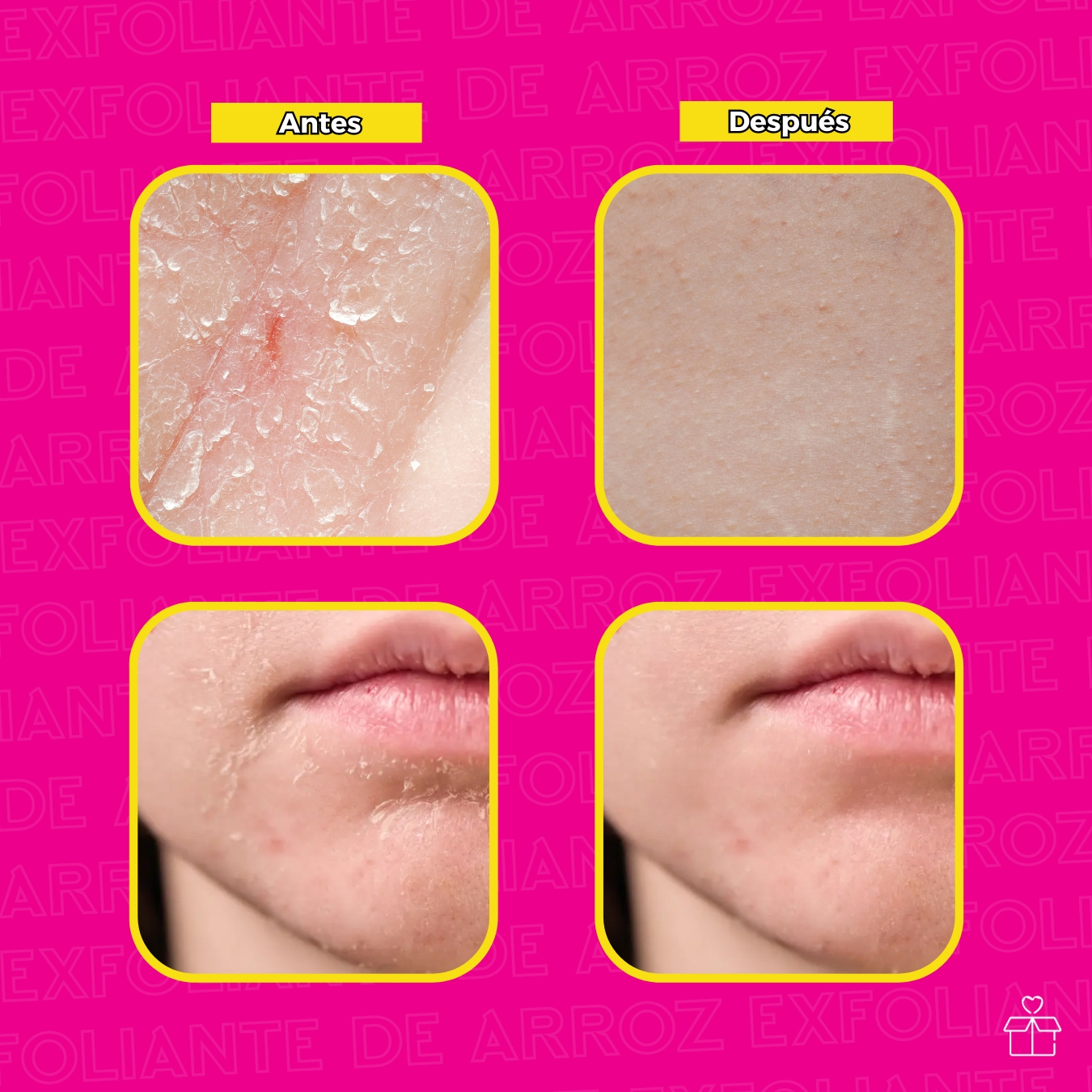 Exfoliante De Arroz Para Limpieza Profunda.