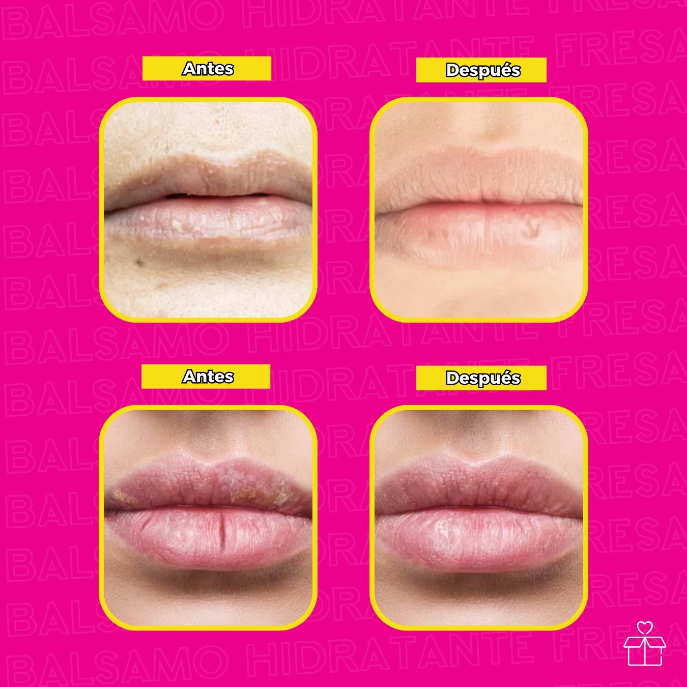 24 Bálsamos Hidratantes de Fresa para Labios Resecos.