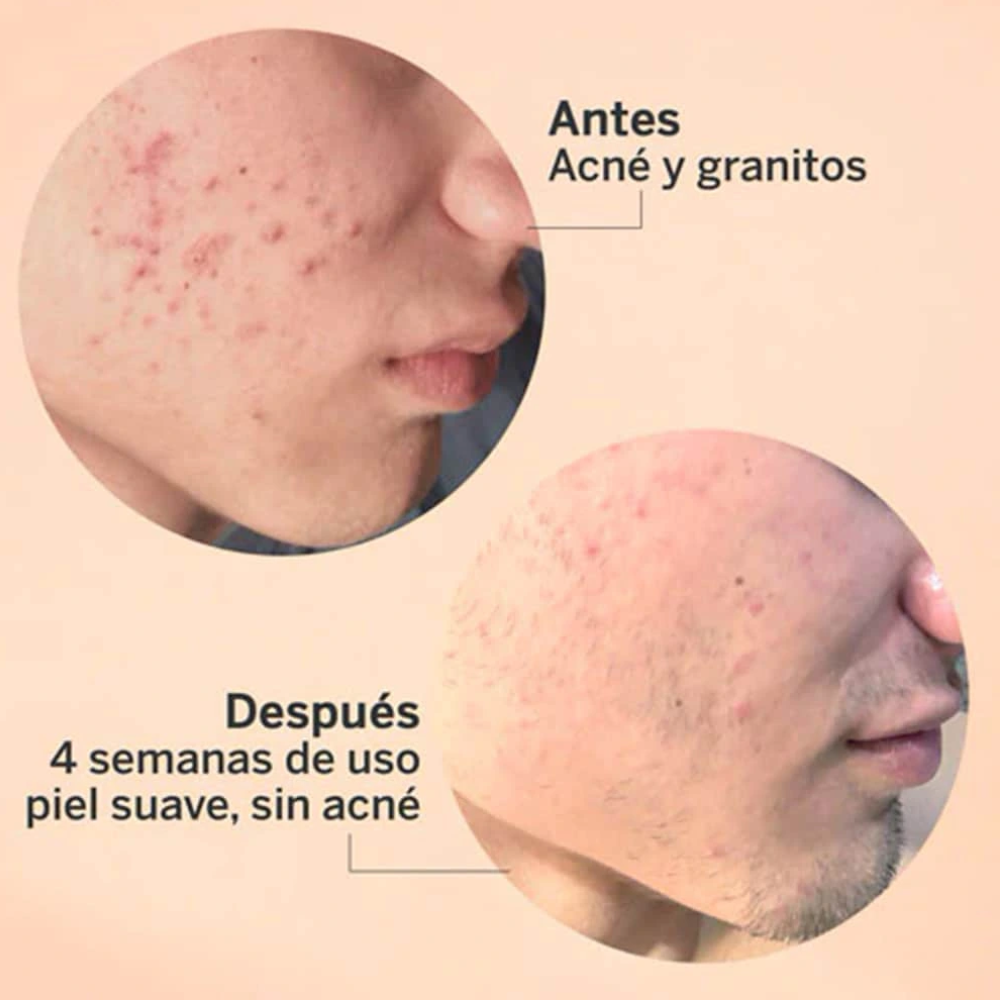 Exfoliante Aha/Bha Suero 30ml (Segle)