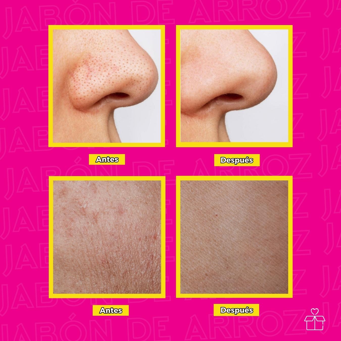 12 Jabones Arroz Tailandes Exfoliante Aclara.