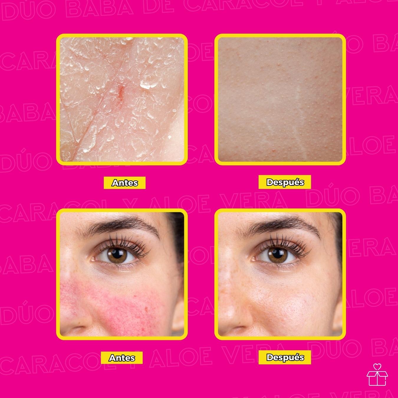 Gel Aloe Vera Y Baba Caracol Hidratante.