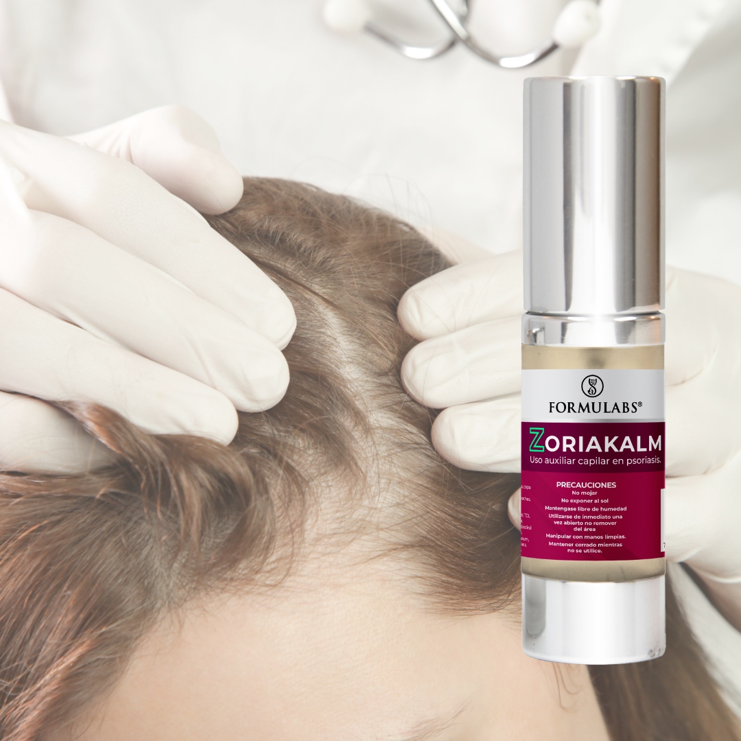 Tratamiento para Psoriasis Capilar, Desinflama, Cicatriza y Calma 30g - Zoriakalm- Formulabs