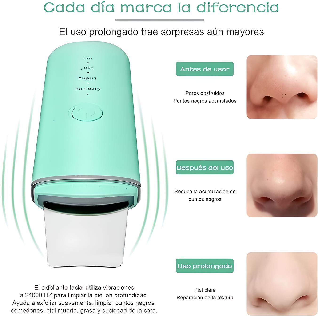 Limpiador Facial Skin Scrubber Peeling Ultrasónico Portátil