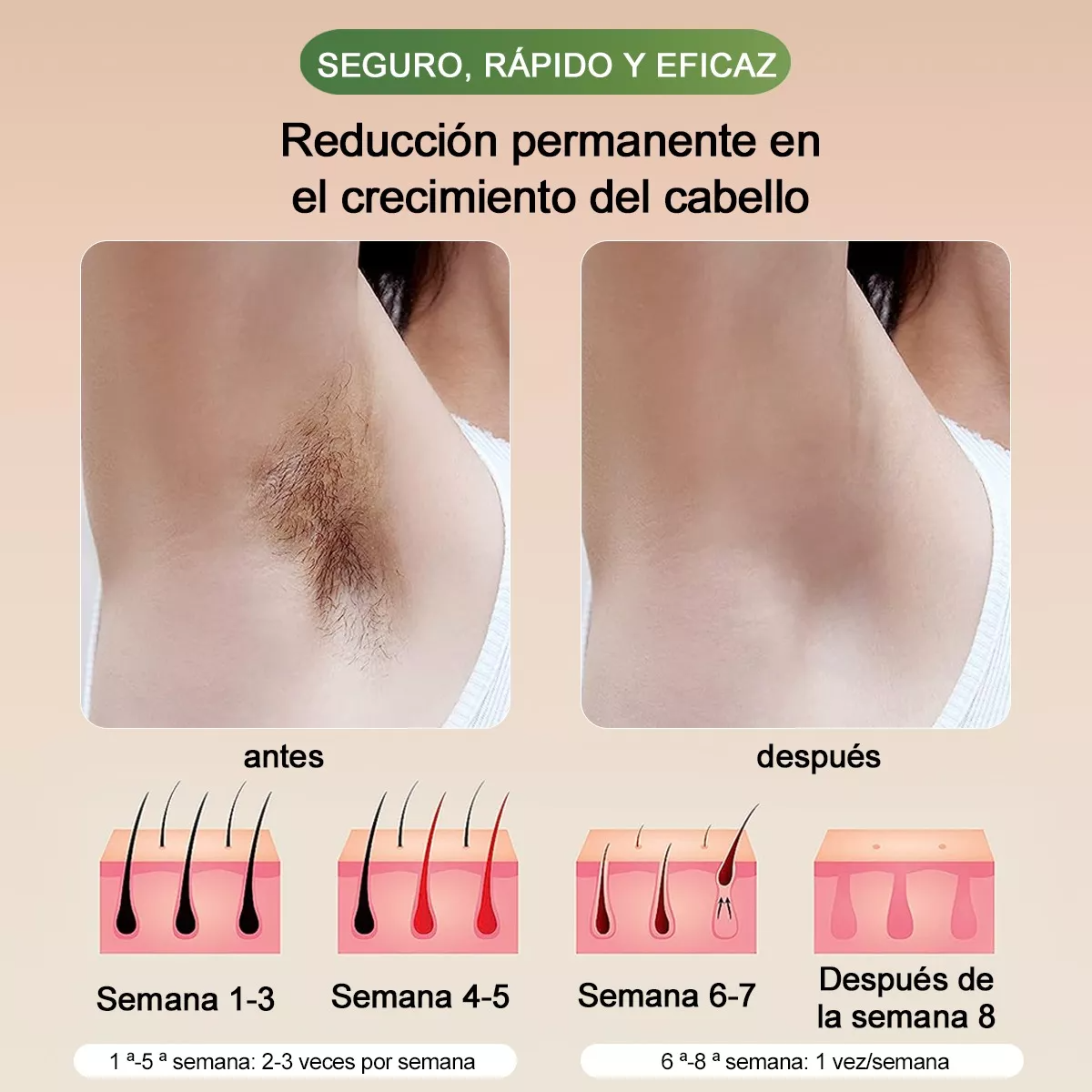 Ipl Depiladora De Pulsada Permanente Láser Facial Y Corporal