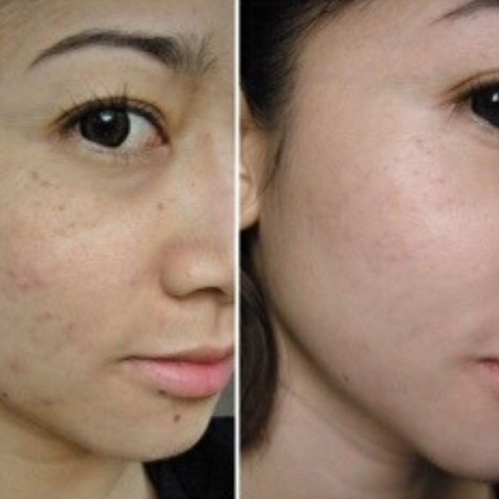 Kit Thanaka Belleza. Ilumina tu piel. Antioxidantes. Bloqueador Solar en Polvo de Thanaka. Protege tu piel. Efecto Botox. Centella Asiática. Thanaka 