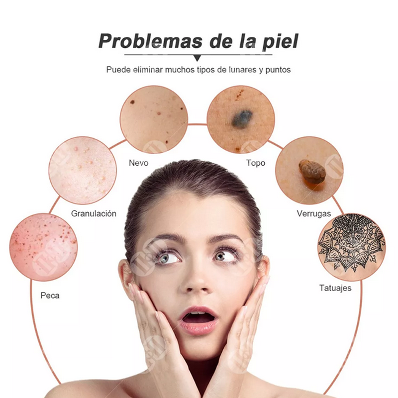 Pluma dermatologica Quita lunares Verrugas Remueve Manchas Pecas Tatuajes