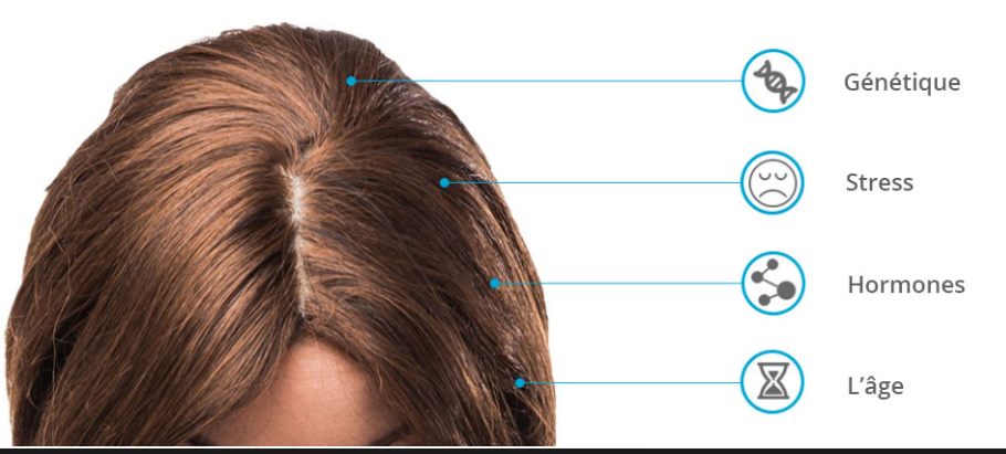 Foligain Minoxidil 2% para mujeres con cabello fino o alopecia 3 frascos para 3 meses de tratamiento.